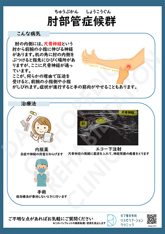 【画像】肘部管症候群について