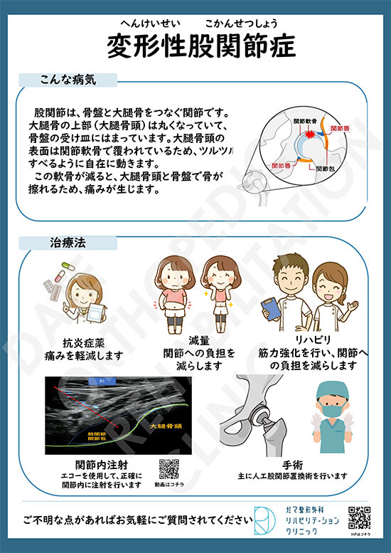 【画像】変形性股関節症について