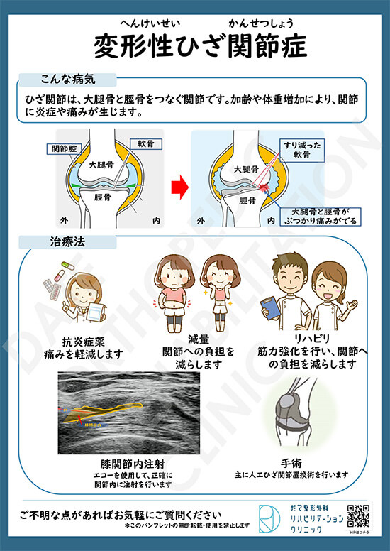 変形 性 膝 関節 症