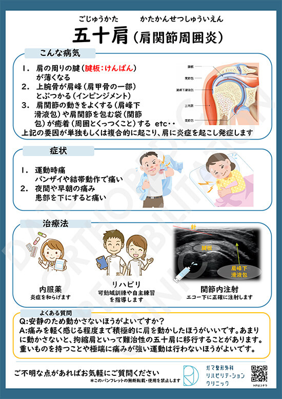 【画像】五十肩について