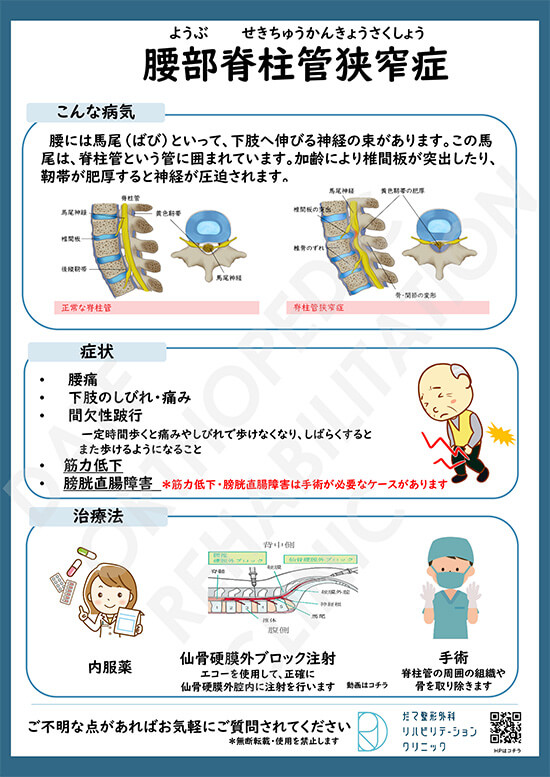 【画像】腰部脊柱管狭窄症について