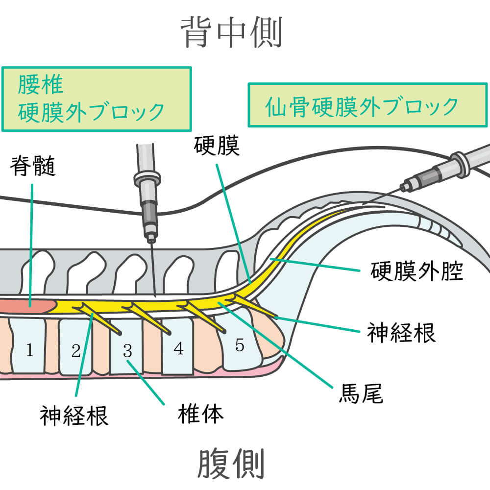 神経ブロック 下関市綾羅木本町の整形外科 リハビリ リウマチ科 だて整形外科リハビリテーションクリニック