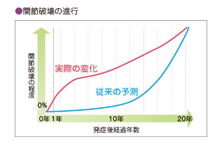 図：関節破壊の急速に進行